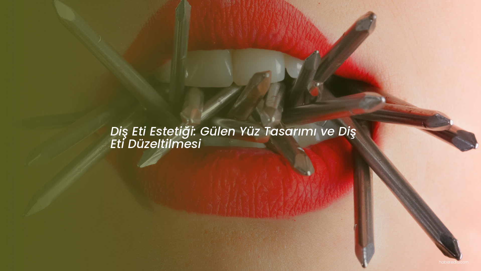 Diş Eti Estetiği: Gülen Yüz Tasarımı ve Diş Eti Düzeltilmesi Diş Eti Estetiği: Gülen Yüz Tasarımı ve Diş Eti Düzeltilmesi