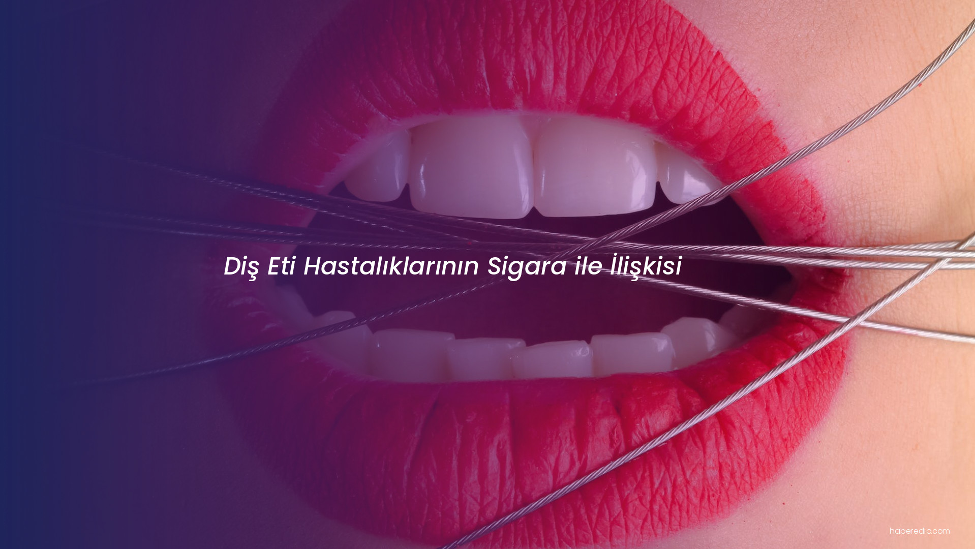 Diş Eti Hastalıklarının Sigara ile İlişkisi Diş Eti Hastalıklarının Sigara ile İlişkisi