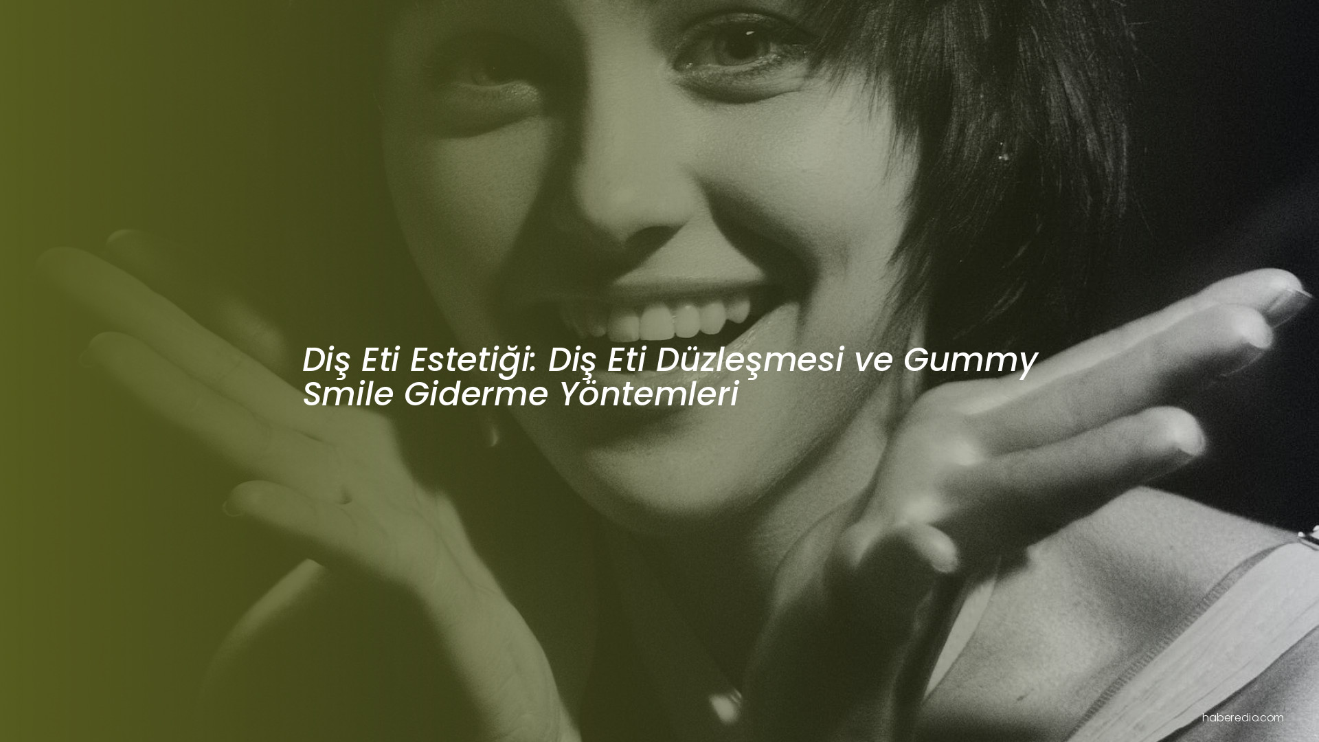 Diş Eti Estetiği: Diş Eti Düzleşmesi ve Gummy Smile Giderme Yöntemleri Diş Eti Estetiği: Diş Eti Düzleşmesi ve Gummy Smile Giderme Yöntemleri