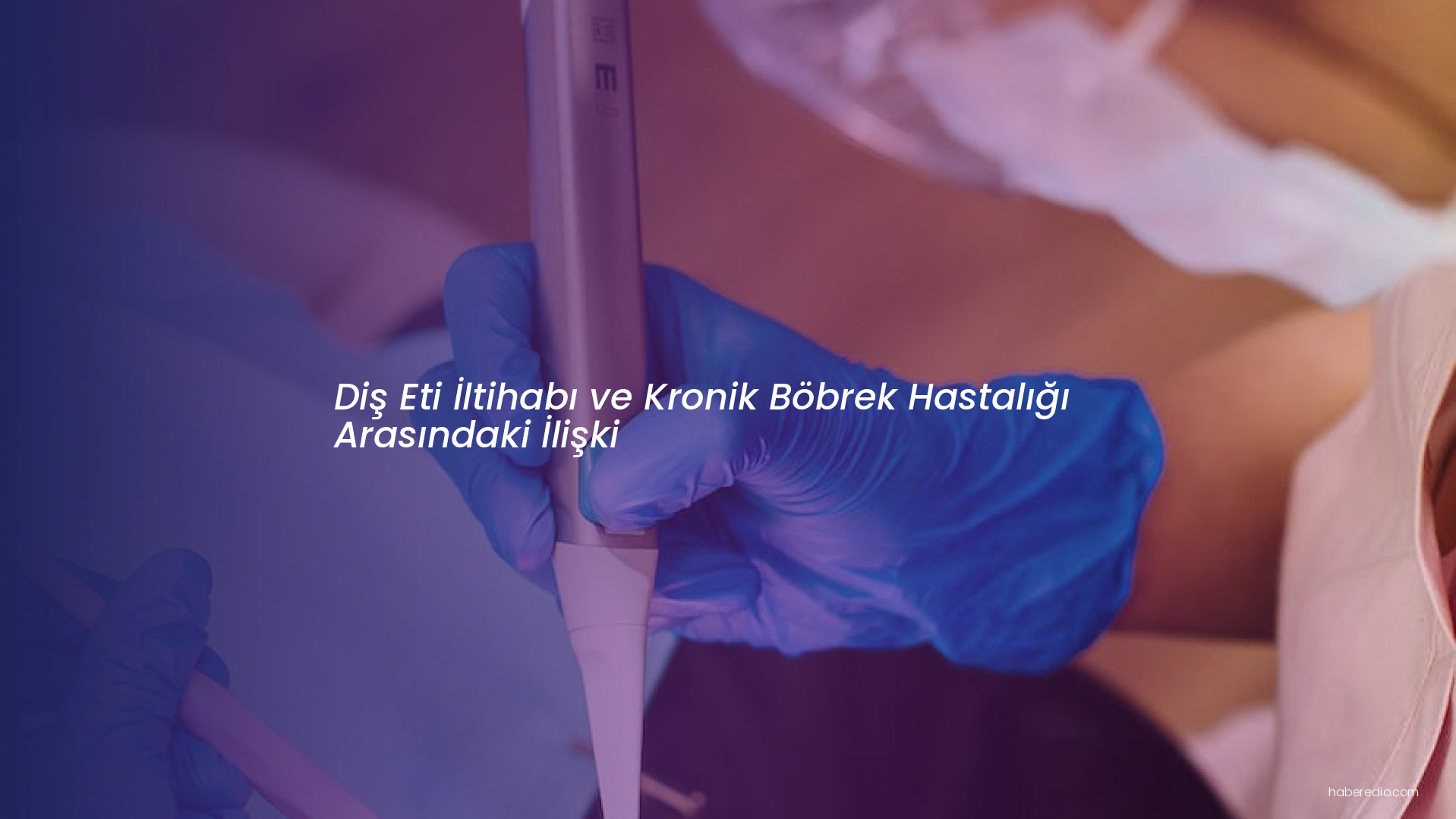 Diş Eti İltihabı ve Kronik Böbrek Hastalığı Arasındaki İlişki Diş Eti İltihabı ve Kronik Böbrek Hastalığı Arasındaki İlişki