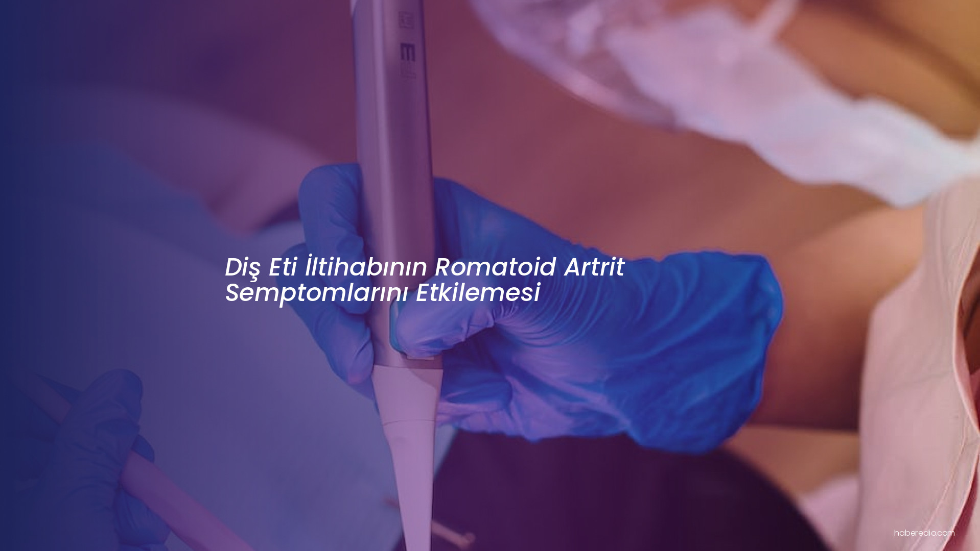 Diş Eti İltihabının Romatoid Artrit Semptomlarını Etkilemesi Diş Eti İltihabının Romatoid Artrit Semptomlarını Etkilemesi