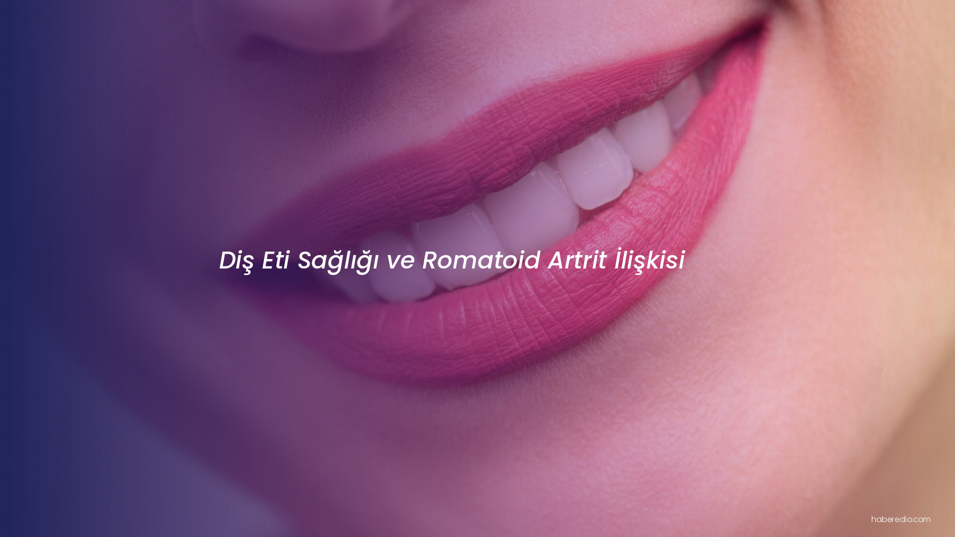 Diş Eti Sağlığı ve Romatoid Artrit İlişkisi Diş Eti Sağlığı ve Romatoid Artrit İlişkisi
