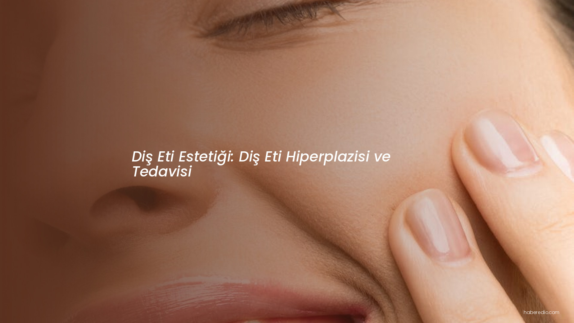 Diş Eti Estetiği: Diş Eti Hiperplazisi ve Tedavisi Diş Eti Estetiği: Diş Eti Hiperplazisi ve Tedavisi